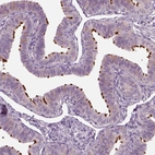 Immunohistochemical staining of human fallopian tube shows high expression.