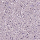 Immunohistochemical staining of human liver shows low expression as expected.