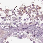 Immunohistochemical staining of human testis using Anti-ARMC3 antibody HPA037823.