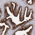 Immunohistochemical staining of human prostate shows high expression.