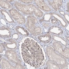 Immunohistochemical staining of human kidney shows low expression as expected.