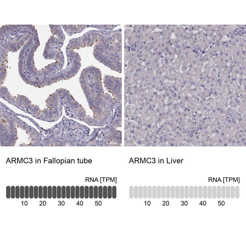 Anti-ARMC3 Antibody
