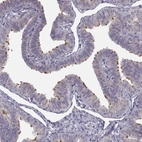 Immunohistochemical staining of human fallopian tube shows high expression.