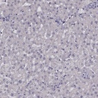 Anti-ARMC3 Antibody