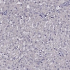 Immunohistochemical staining of human liver shows low expression as expected.