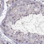 Immunohistochemical staining of human testis using Anti-ARMC3 antibody HPA037824.