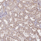Anti-MTG1 Antibody