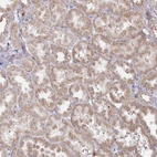 Anti-MTG1 Antibody