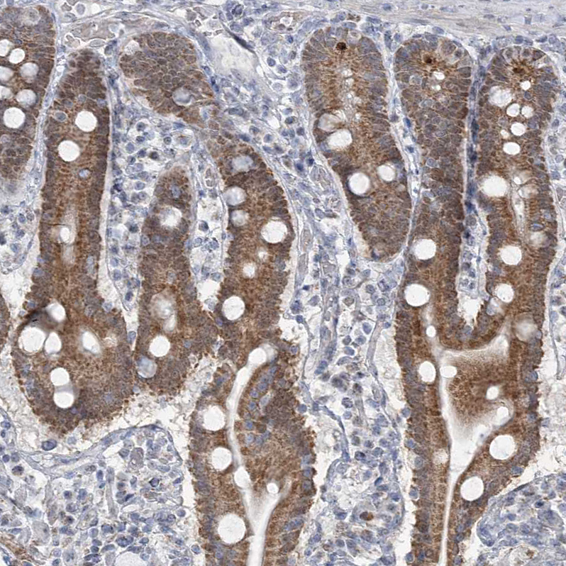 Anti-MTG1 Antibody