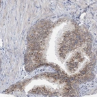 Immunohistochemical staining of human prostate shows moderate granular cytoplasmic positivity in glandular cells.