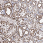 Immunohistochemical staining of human kidney shows moderate granular cytoplasmic positivity in cells in tubules.