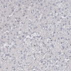 Immunohistochemical staining of human liver shows very weak granular cytoplasmic positivity in hepatocytes.