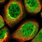 Immunofluorescent staining of human cell line A-431 shows localization to nucleoplasm, cytosol & the Golgi apparatus.