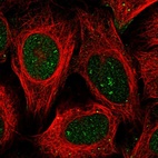 Immunofluorescent staining of human cell line U-2 OS shows localization to nucleus, nucleoli fibrillar center & vesicles.
