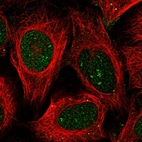 Immunofluorescent staining of human cell line U-2 OS shows localization to nucleus, nucleoli fibrillar center & vesicles.