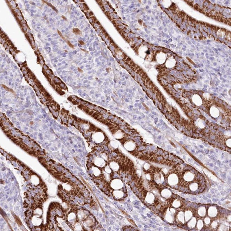 Anti-ZFAND4 Antibody