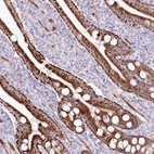Anti-ZFAND4 Antibody