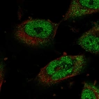 Immunofluorescent staining of human cell line U-251 MG shows localization to nucleoplasm & cytosol.