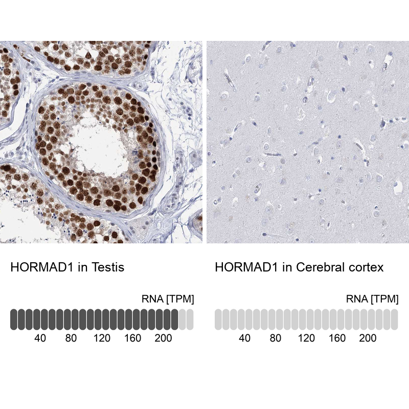 Anti-HORMAD1 Antibody