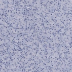 Immunohistochemical staining of human pancreas shows no positivity in exocrine glandular cells as expected.