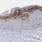 Immunohistochemical staining of human skin shows cytoplasmic positivity in a subset of squamous epithelial cells.