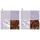 Immunohistochemical staining of human liver, pancreas, prostate and skeletal muscle using Anti-MYOZ1 antibody HPA037848 (A) shows similar protein distribution across tissues to independent antibody HPA038437 (B).