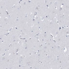 Immunohistochemical staining of human cerebral cortex shows no positivity in neurons as expected.