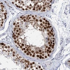 Immunohistochemical staining of human testis shows strong nuclear positivity in cells in seminiferous ducts.