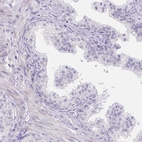 Immunohistochemical staining of human prostate shows no positivity in glandular cells as expected.