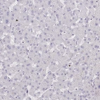 Immunohistochemical staining of human liver shows no positivity in hepatocytes as expected.