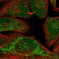 Anti-IGSF22 Antibody