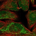 Anti-IGSF22 Antibody