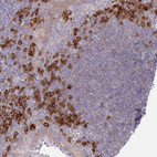 Anti-POGLUT1 Antibody