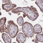 Immunohistochemical staining of human placenta shows moderate cytoplasmic positivity in trophoblastic cells.