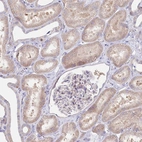 Immunohistochemical staining of human kidney shows weak cytoplasmic positivity in cells in tubules.