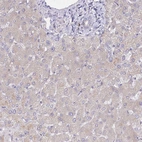 Immunohistochemical staining of human liver shows no positivity in hepatocytes as expected.