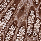 Immunohistochemical staining of human rectum shows strong cytoplasmic positivity in glandular cells.
