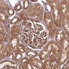 Immunohistochemical staining of human kidney shows strong cytoplasmic positivity in cells in tubules.