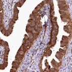 Immunohistochemical staining of human fallopian tube shows strong cytoplasmic positivity in glandular cells.