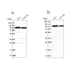 Western blot analysis using Anti-COPG1 antibody HPA037866 (A) shows similar pattern to independent antibody HPA037867 (B).