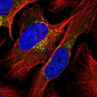 Immunofluorescent staining of human cell line U-2 OS shows localization to the Golgi apparatus.