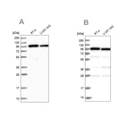 Western blot analysis using Anti-COPG1 antibody HPA037867 (A) shows similar pattern to independent antibody HPA037866 (B).