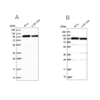 Western blot analysis using Anti-COPG1 antibody HPA037867 (A) shows similar pattern to independent antibody HPA037866 (B).