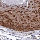 Immunohistochemical staining of human skin using Anti-WAPL antibody HPA037874.