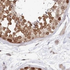Immunohistochemical staining of human testis using Anti-WAPL antibody HPA037874.