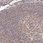 Immunohistochemical staining of human lymph node using Anti-WAPL antibody HPA037874.