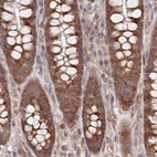Immunohistochemical staining of human colon using Anti-WAPL antibody HPA037874.