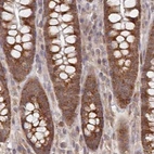 Immunohistochemical staining of human colon using Anti-WAPL antibody HPA037874.
