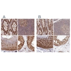 Anti-WAPL Antibody