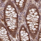 Immunohistochemical staining of human colon using Anti-WAPL antibody HPA037875.